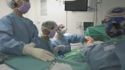 Cirurgia endoscòpica de càncer de mama